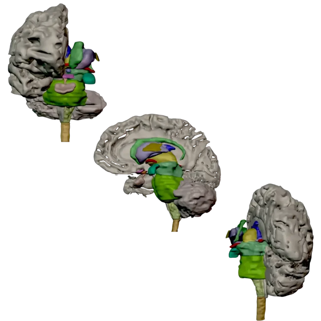 Modelos tridimensionais de estruturas do encéfalo