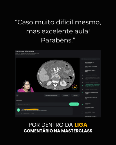 depoimento LIGA - aula Nat