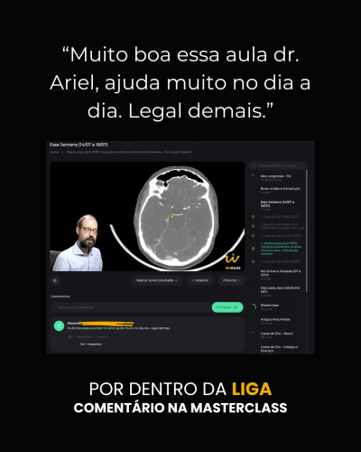 depoimento LIGA - aula ariel